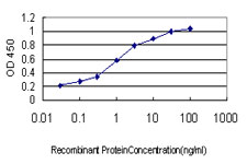 E - S100A6 Antibody (monoclonal) (M16) AT3760a